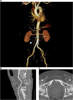 Cardiac Computed Tomography: Application in Valvular Heart Disease